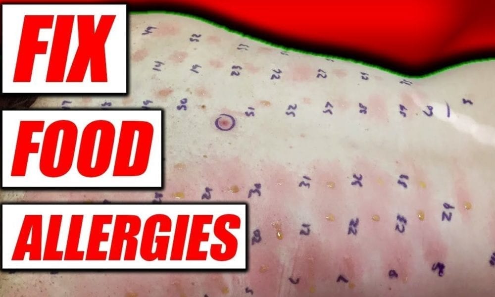 Food Allergies | How To Fix & Diagnose Them